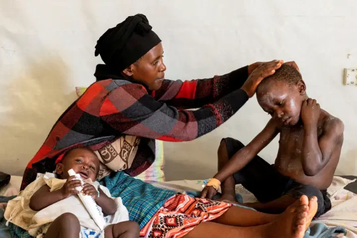 Mpox doses to start to arrive in Congo