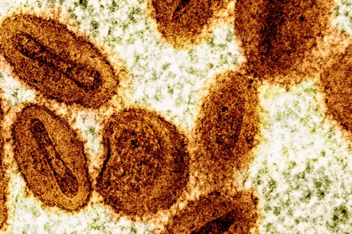 Germany detects first mpox variant Ib case