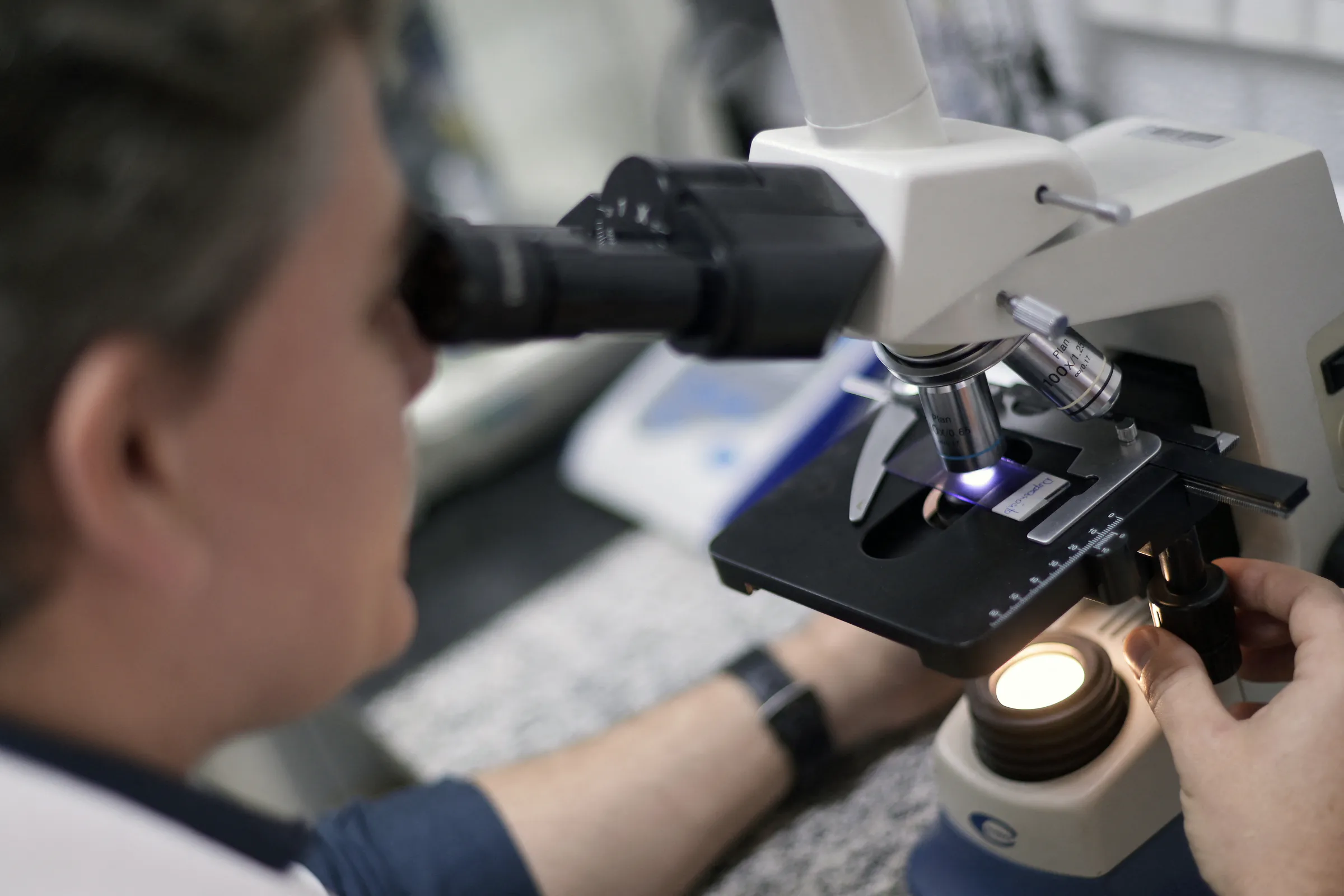 KU Leuven researchers develop method to permanently disable HIV virus