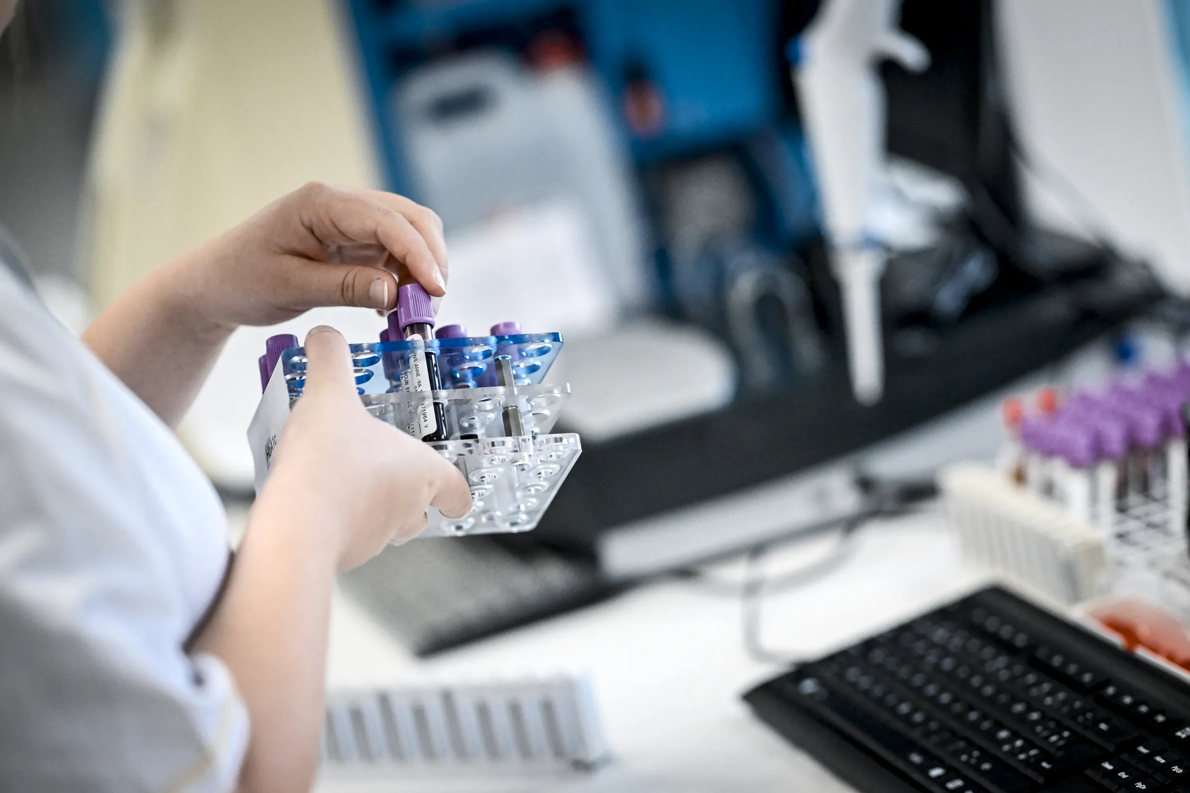 US funding cut threatens HIV research at Ghent University Hospital