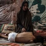 Doctors in Gaza face rising cases of rare paralytic illness amid ongoing Israeli blockade