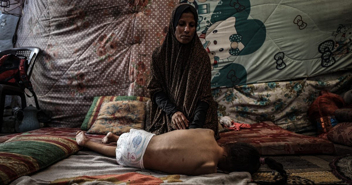 Doctors in Gaza face rising cases of rare paralytic illness amid ongoing Israeli blockade