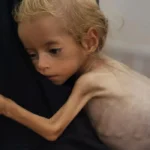 Gaza health ministry reports 100 children dead from malnutrition amid ongoing crisis